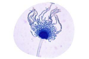 Aspergillus flavus.