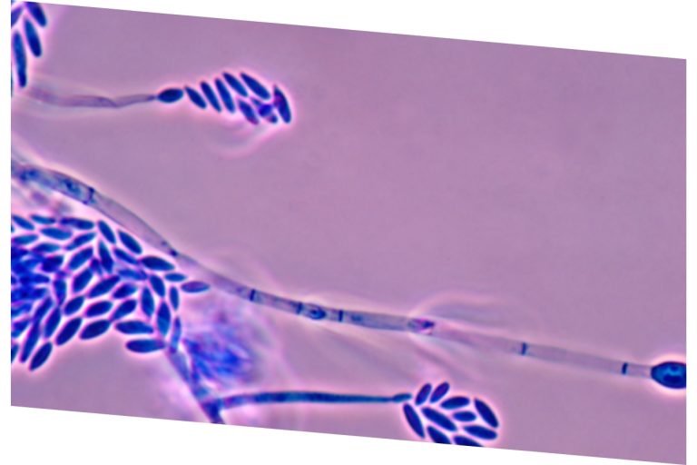 Fusarium sporotrichoides.